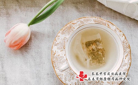 治疗荨麻疹的常用方法有哪些?