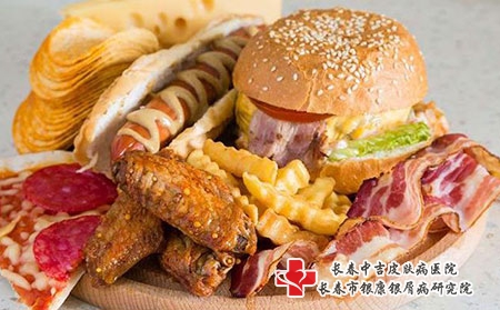 2 (285)油炸饮食
