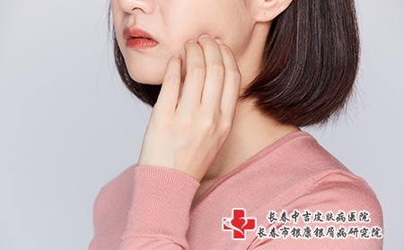 摄图网_501684066_女性被蚊虫叮咬抓脸颊牙疼（企业商用）