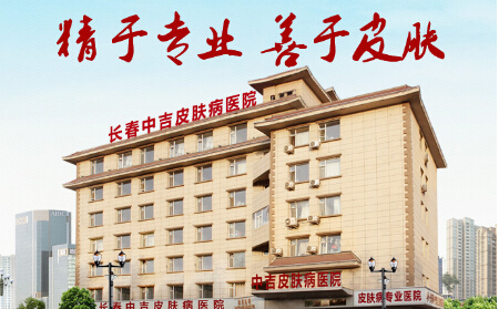 女性银屑病患者在平时应该注意什么