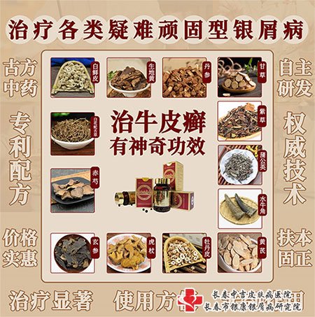 有没有人吃过长春中吉医院的参地肤康丸
