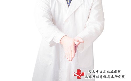 女性银屑病病因,女性为什么得银屑病