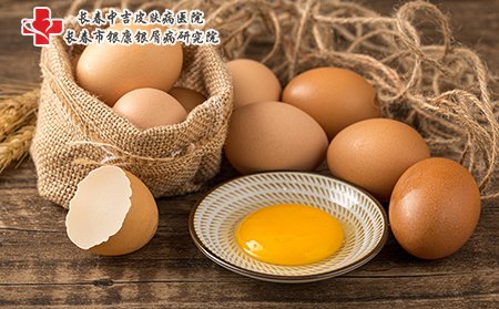 荨麻疹患者少吃鸡蛋，还有要注意其他饮食