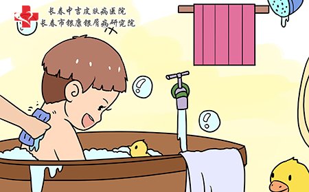 湿疹要给宝宝正确洗澡
